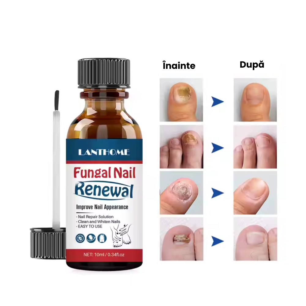 Tratament Reparator Anti-Fungic 10ml pentru Unghii Sănătoase