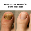 Tratament Reparator Anti-Fungic 10ml pentru Unghii Sănătoase